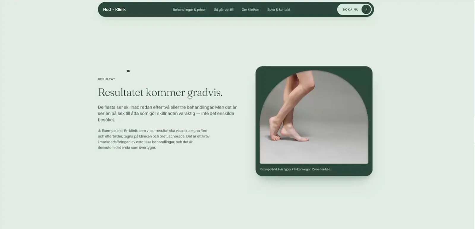 Laserklinik — resultatsektionen: skillnaden kommer gradvis