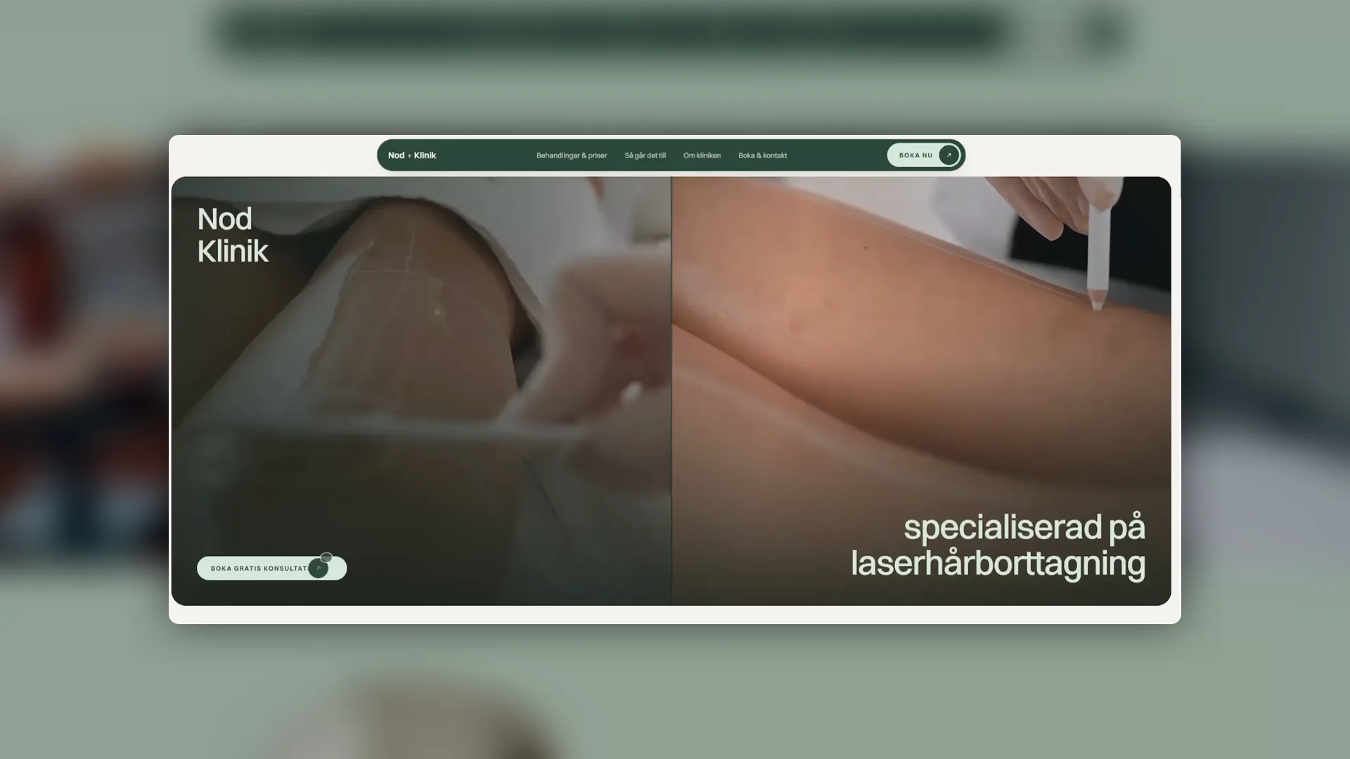 Laserklinik — startsidan visad i en mockup
